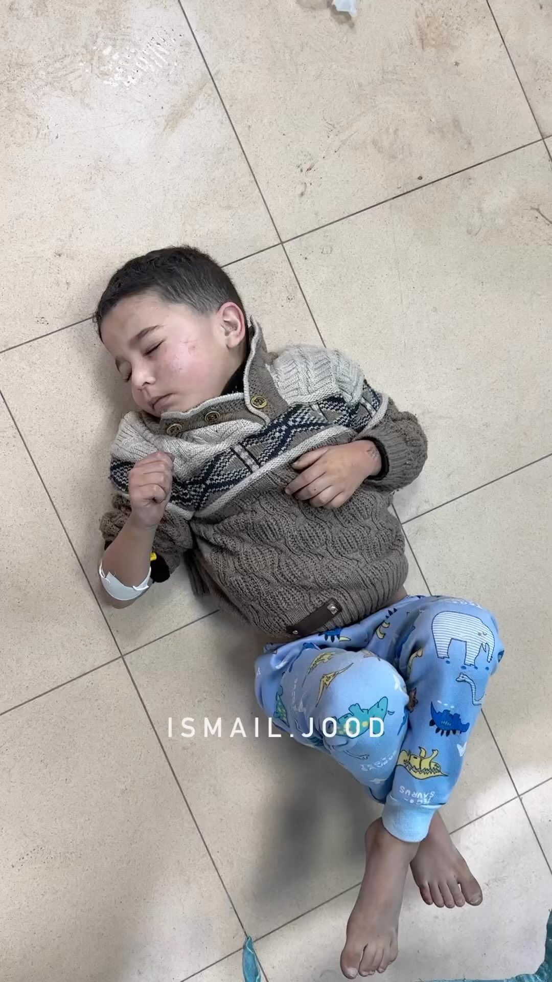a-little-child-slept-on-the-floor-whilst-receiving-medical-treatment-in-the-hospital-following-his-injury-by-an-air-stri…