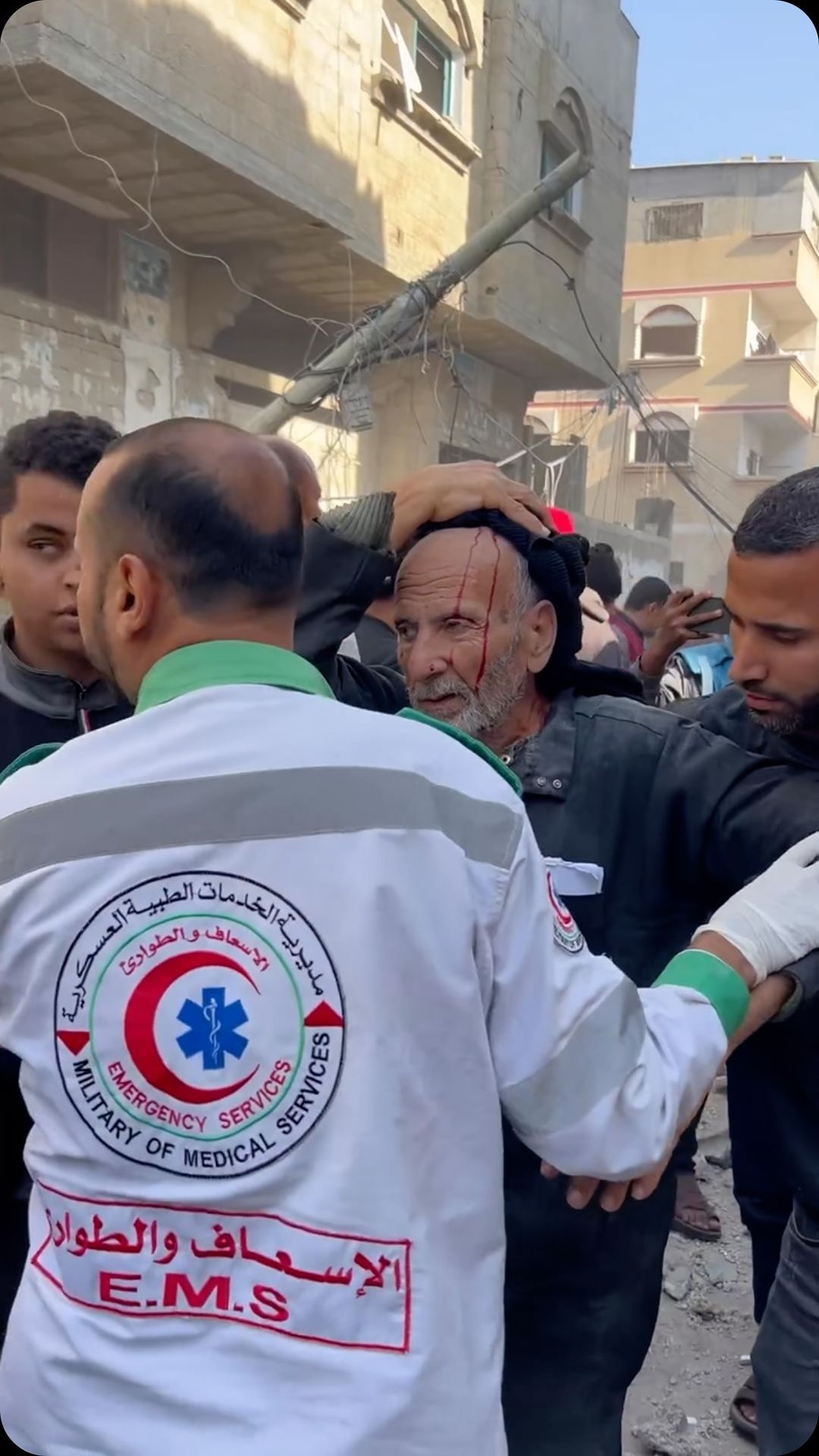 israeli-warplanes-bomb-a-home-near-naser-hospital-in-khan-younis-2912.23-via-@saleh-aljafarawi-

إصابات-بعد-قصف-الاحتل…