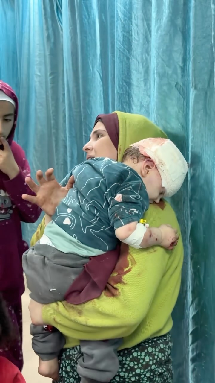 palestinian-children-receive-medical-treatment-following-their-injury-by-israeli-air-strikes-in-gaza-strip-3212.23-via…
